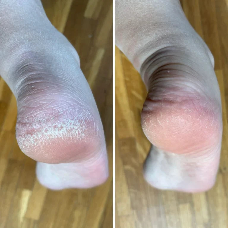 NanoGlass Foot File