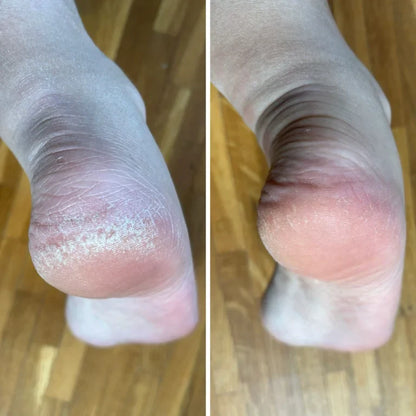 NanoGlass Foot File