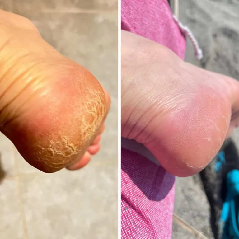 NanoGlass Foot File